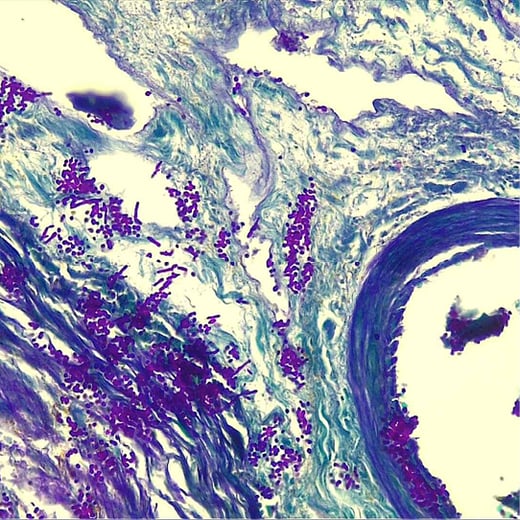 Image Periodic Acid Schiff