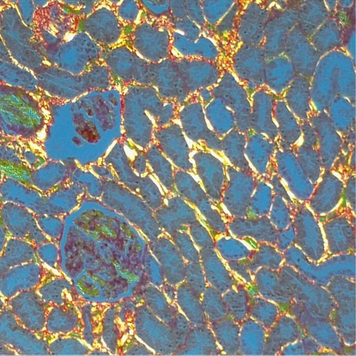 Image Picro-Sirius Red Stain