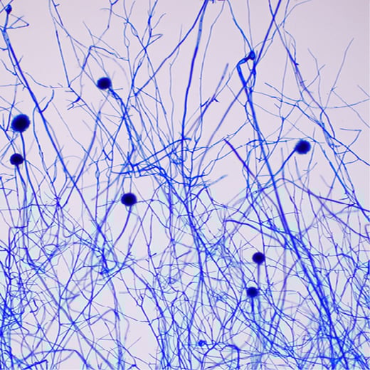 Image Lacto Phenol Cotton Blue